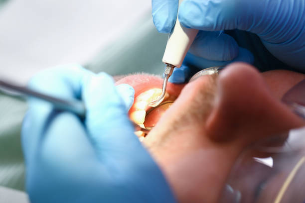 Best Emergency Treatment for Jaw Pain or Injury in Woodson Terrace, MO