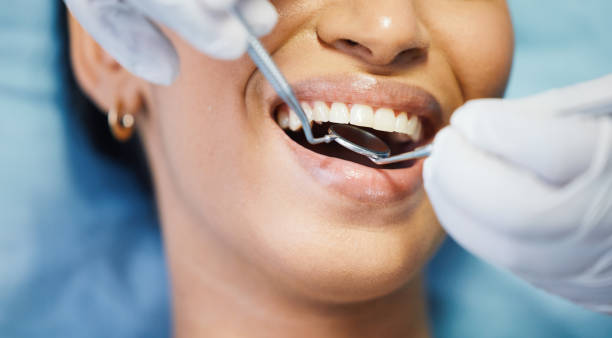 Best Emergency Treatment for Oral Infections in Woodson Terrace, MO